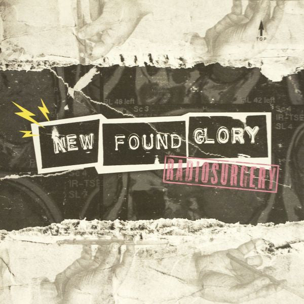 New Found Glory - Radiosurgery / Giving Up On Me (Coloured)