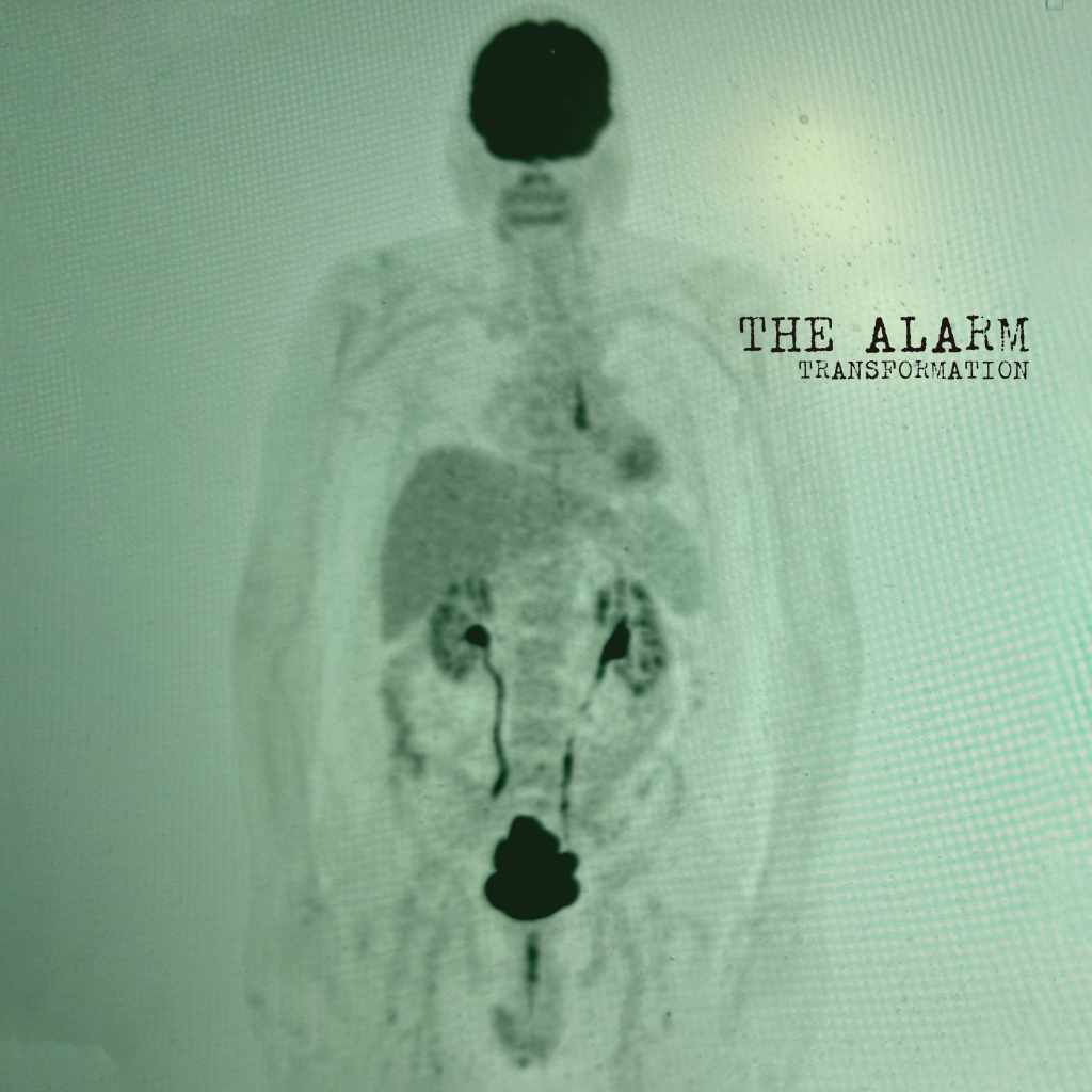 Alarm - Transformation