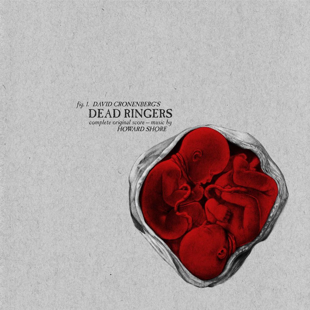 OST - Dead Ringers